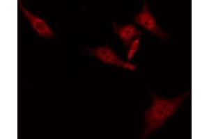 ABIN6274860 staining Hela by IF/ICC.