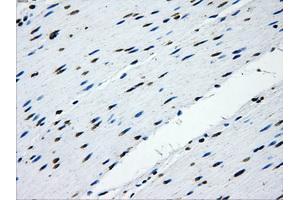 Immunohistochemical staining of paraffin-embedded Kidney tissue using anti-IFIT3mouse monoclonal antibody.