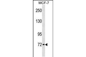 Western blot analysis in MCF-7 cell line lysates (35ug/lane). (CPT2 anticorps  (AA 212-241))