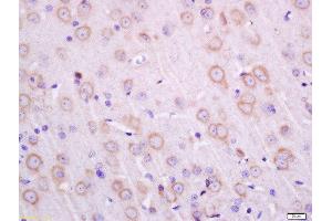 Formalin-fixed and paraffin embedded rat brain labeled with Anti-Transmembrane Protein 30A Polyclonal Antibody, Unconjugated  at 1:200 followed by conjugation to the secondary antibody and DAB staining.