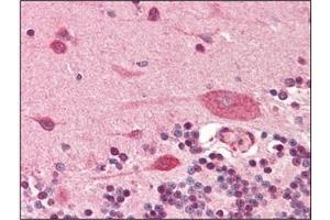 Immunohistochemistry (IHC) image for anti-Podoplanin (PDPN) (AA 1-206), (N-Term) antibody (ABIN302234)