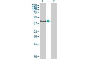 Lane 1: FCGR2B transfected lysate ( 34 KDa) Lane 2: Non-transfected lysate. (FCGR2B 293T Cell Transient Overexpression Lysate(Denatured))