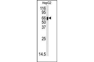 Image no. 1 for anti-Angiotensinogen (serpin Peptidase Inhibitor, Clade A, Member 8) (AGT) (N-Term) antibody (ABIN360211) (AGT anticorps  (N-Term))