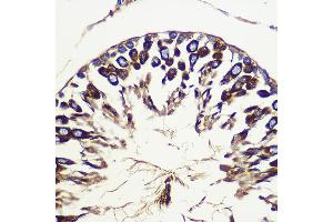 Immunohistochemistry of paraffin-embedded Rat testis using  Rabbit pAb (ABIN6133192, ABIN6137243, ABIN6137244 and ABIN6223255) at dilution of 1:100 (40x lens).