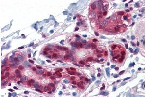 Human Breast: Formalin-Fixed, Paraffin-Embedded (FFPE) (YAP1 anticorps  (AA 53-162))