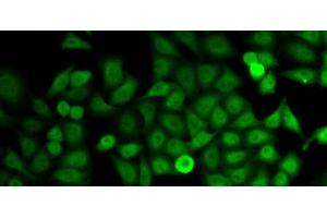 Immunofluorescence analysis of HeLa cells using IMPDH2 Polyclonal Antibody (IMPDH2 anticorps)