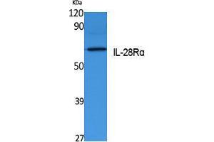Western Blotting (WB) image for anti-Interleukin 28 Receptor, alpha (Interferon, lambda Receptor) (IL28RA) (Internal Region) antibody (ABIN3178120) (IL28RA anticorps  (Internal Region))