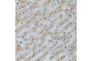 Immunohistochemistry of paraffin-embedded human liver injury using MAPK1 antibody.