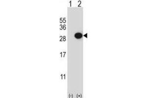 Western Blotting (WB) image for anti-Collagen Triple Helix Repeat Containing 1 (CTHRC1) antibody (ABIN3003906) (CTHRC1 anticorps)