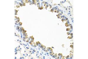Immunohistochemistry of paraffin-embedded mouse lung using TICAM1 antibody.