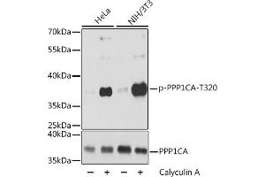 Western blot analysis of extracts of various cell lines, using Phospho-PPP1CA-T320 antibody (ABIN7269674) at 1:2000 dilution or PPP1CA antibody (ABIN6128485, ABIN6146053, ABIN6146054 and ABIN6216107).