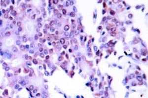 Image no. 1 for anti-Nuclear Factor-kB p65 (NFkBP65) antibody (ABIN271748) (NF-kB p65 anticorps)