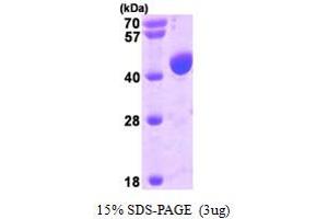 SDS-PAGE (SDS) image for Programmed Cell Death 6 Interacting Protein (PDCD6IP) (AA 1-392) protein (His tag) (ABIN666945)