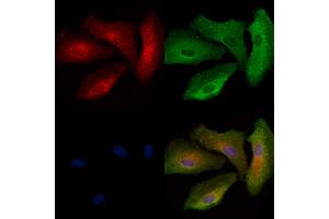 ABIN6263951 and ABIN6272734 staining  cells by IF/ICC. (LPAR6 anticorps  (Internal Region))