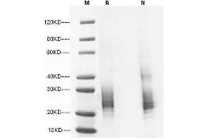 5 μg of IL-7,His, Mouse  was resolved with SDS-PAGE under reducing (R) and non-reducing (N) conditions and visualized by Coomassie Blue staining.