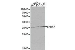 Western Blotting (WB) image for anti-Speedy Homolog A (SPDYA) antibody (ABIN1874919) (SPDYA anticorps)