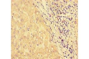 Immunohistochemistry of paraffin-embedded human liver tissue using ABIN7154859 at dilution of 1:100 (HSPA13 anticorps  (AA 23-471))
