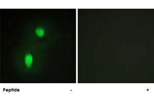 Immunofluorescence analysis of HUVEC cells, using HNRNPC polyclonal antibody . (HNRNPC anticorps)
