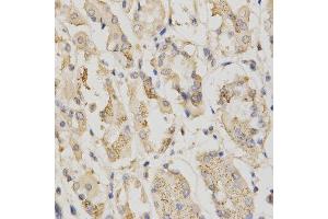 Immunohistochemistry of paraffin-embedded human stomach using STK11 antibody at dilution of 1:200 (x400 lens)