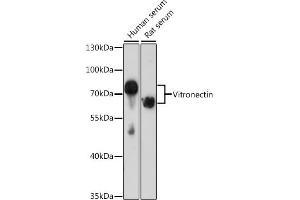 Western blot analysis of extracts of various cell lines, using Vitronectin antibody (ABIN3022357, ABIN3022358, ABIN3022359 and ABIN6218758) at 1:1000 dilution. (Vitronectin anticorps  (AA 364-478))