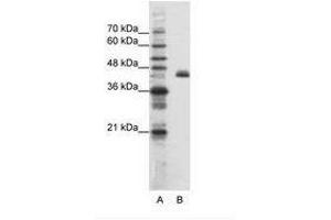 Image no. 1 for anti-Zinc Finger Protein 36, C3H Type-Like 2 (ZFP36L2) (N-Term) antibody (ABIN202655) (ZFP36L2 anticorps  (N-Term))