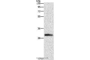 Western blot analysis of Mouse heart tissue, using DCK Polyclonal Antibody at dilution of 1:550 (DCK anticorps)