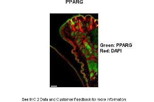 Mouse cornea and eyelid Primary Antibody Dilution: 1:100Secondary Antibody: Goat anti-rabbit-AlexaFluor-546 Secondary Antibody Dilution: 1:0000Color/Signal Descriptions: PPARG: Green DAPI: Red  Gene Name: Ppar Gamma  Submitted by: Anonymous (PPARG anticorps  (N-Term))