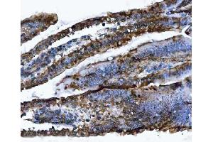 IHC analysis of VAPA using anti-VAPA antibody (ABIN7603249). (VAPA anticorps  (N-Term))