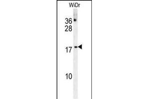 CHCHD2 Antibody (Center) (ABIN654013 and ABIN2843939) western blot analysis in WiDr cell line lysates (35 μg/lane). (CHCHD2 anticorps  (AA 74-103))