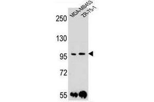 PCDH1 Antibody (N-term) western blot analysis in MDA-MB453,ZR-75-1 cell line lysates (35µg/lane). (Protocadherin 1 anticorps  (N-Term))