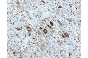 Rat cerebellum, formalin-fixed paraffin embedded tissue, with citrate pre-treatment, 20X. (Gephyrin anticorps  (AA 569-726))