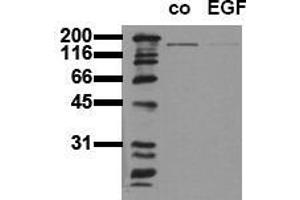 Western Blotting (WB) image for anti-Epidermal Growth Factor Receptor (EGFR) (Tyr1197) antibody (ABIN126780) (EGFR anticorps  (Tyr1197))