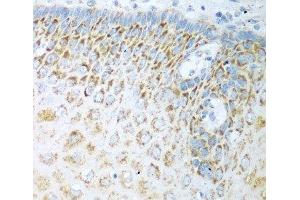 Immunohistochemistry of paraffin-embedded Human esophagus using FDXR Polyclonal Antibody at dilution of 1:100 (40x lens). (Ferredoxin Reductase anticorps)