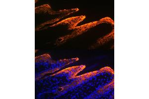 Immunofluorescence analysis of human skin using Cytokeratin 10 Rabbit mAb (ABIN1679404, ABIN3019133, ABIN3019134 and ABIN7101721) at dilution of 1:100 (40x lens). (Keratin 10 anticorps)