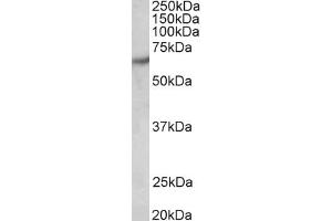 Western Blotting (WB) image for anti-P21-Activated Kinase 1 (PAK1) antibody (ABIN5904050) (PAK1 anticorps)