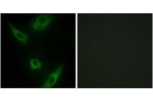 Immunofluorescence analysis of HeLa cells, using MAP3K1 Antibody. (MAP3K1 anticorps  (AA 181-230))