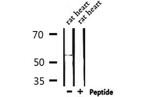 Western blot analysis of extracts from rat heart , using MMP10 Antibody.