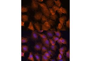 Immunofluorescence analysis of C6 cells using SCRN3 antibody (ABIN7270176) at dilution of 1:100.
