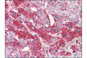 Immunohistochemistry: GLP2R antibody staining of Formalin-Fixed, Paraffin-Embedded Human Liver. (GLP2R anticorps  (Extracellular Domain, N-Term))