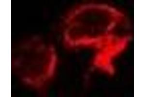 Immunofluorescent analysis of OSGEPL1 staining in A549 cells. (OSGEPL1 anticorps)