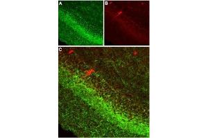 Expression of CB1 receptor in rat hippocampusImmunohistochemical staining of rat hippocampus using Anti-Cannabinoid Receptor 1 (extracellular) Antibody (ABIN7043023, ABIN7044155 and ABIN7044156) (1:100).