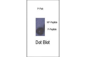 Dot Blot (DB) image for anti-Retinoblastoma 1 (RB1) (pSer780) antibody (ABIN3001784)