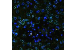 IF analysis of Emerin using anti-Emerin antibody (ABIN4886569). (Emerin anticorps  (N-Term))