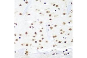 Immunohistochemistry of paraffin-embedded mouse brain using HTATSF1 antibody at dilution of 1:100 (40x lens). (HTATSF1 anticorps)