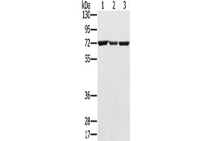 Western Blotting (WB) image for anti-Solute Carrier Family 25, Member 13 (Citrin) (slc25a13) antibody (ABIN2424163) (slc25a13 anticorps)