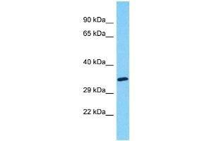Western Blotting (WB) image for anti-Myeloid-Associated Differentiation Marker-Like 2 (MYADML2) (C-Term) antibody (ABIN2791681) (MYADML2 anticorps  (C-Term))