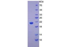 SDS-PAGE analysis of Human alpha Fodrin Protein. (SPTAN1 Protéine)