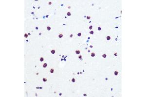 Immunohistochemistry of paraffin-embedded rat brain using P Rabbit mAb (ABIN7269445) at dilution of 1:100 (40x lens). (PABPN1 anticorps)