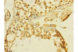 Immunohistochemistry of paraffin-embedded human testis tissue using ABIN7172811 at dilution of 1:100 (TGFBR3 anticorps  (AA 140-340))
