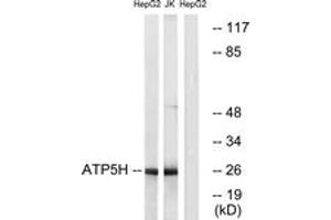 Western blot analysis of extracts from HepG2/Jurkat cells, using ATP5H Antibody. (ATP5H anticorps  (AA 111-160))